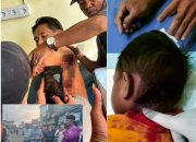 Korban Gigitan Monyet Liar di Inhil Bertambah Jadi 15 Orang, Seorang Anak Digigit di Bagian Leher