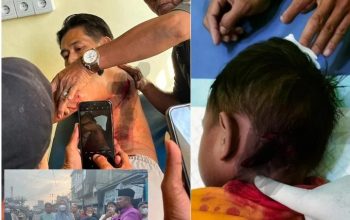 Korban Gigitan Monyet Liar di Inhil Bertambah Jadi 15 Orang, Seorang Anak Digigit di Bagian Leher
